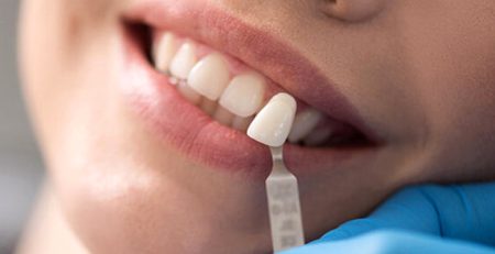 2026 Lamine Dis Kaplama Fiyatlari Yaprak Porselen Ne Kadar