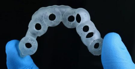 Dikissiz Implant Tedavisinin Avantajlari – Dogal Gulusunuzu Geri Kazanin