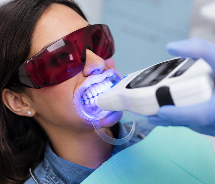 Is Sensitivity After Tooth Whitening Normal?