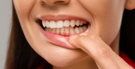 Dis Eti Cekilmesi Nedir Neden Olur ve Nasil Tedavi Edilir