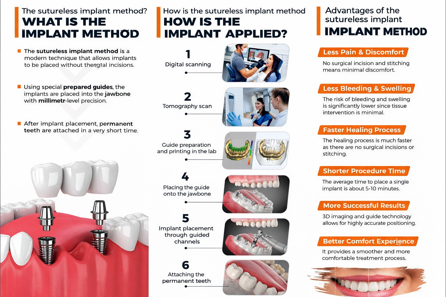 Stitchless Implant Treatment Stitchless Implant Treatment