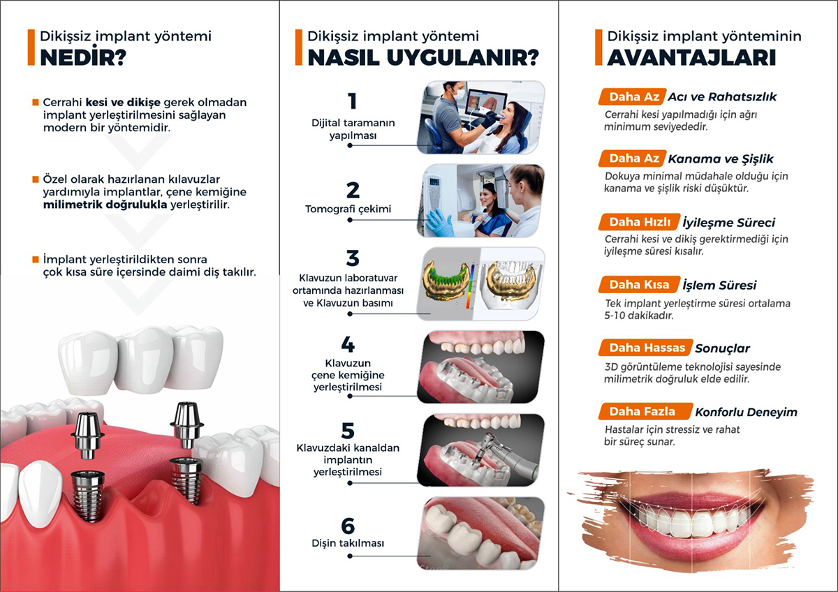dikissiz implant aciklama