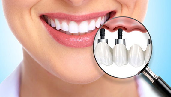 implantblok