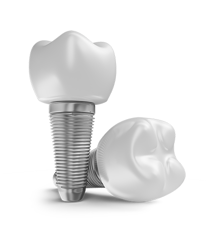melsadent dental implant