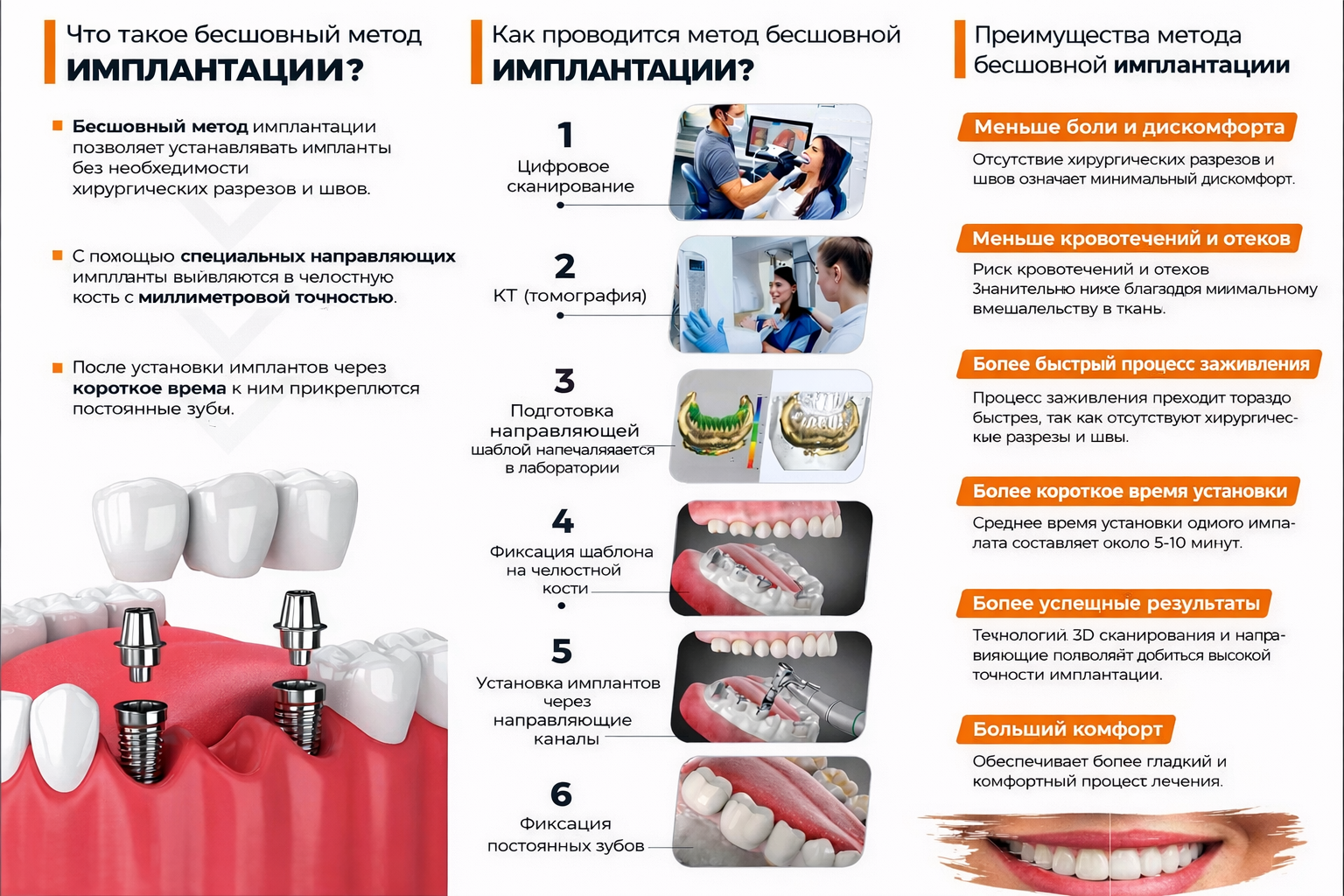 Имплант без швов навигационный имплант